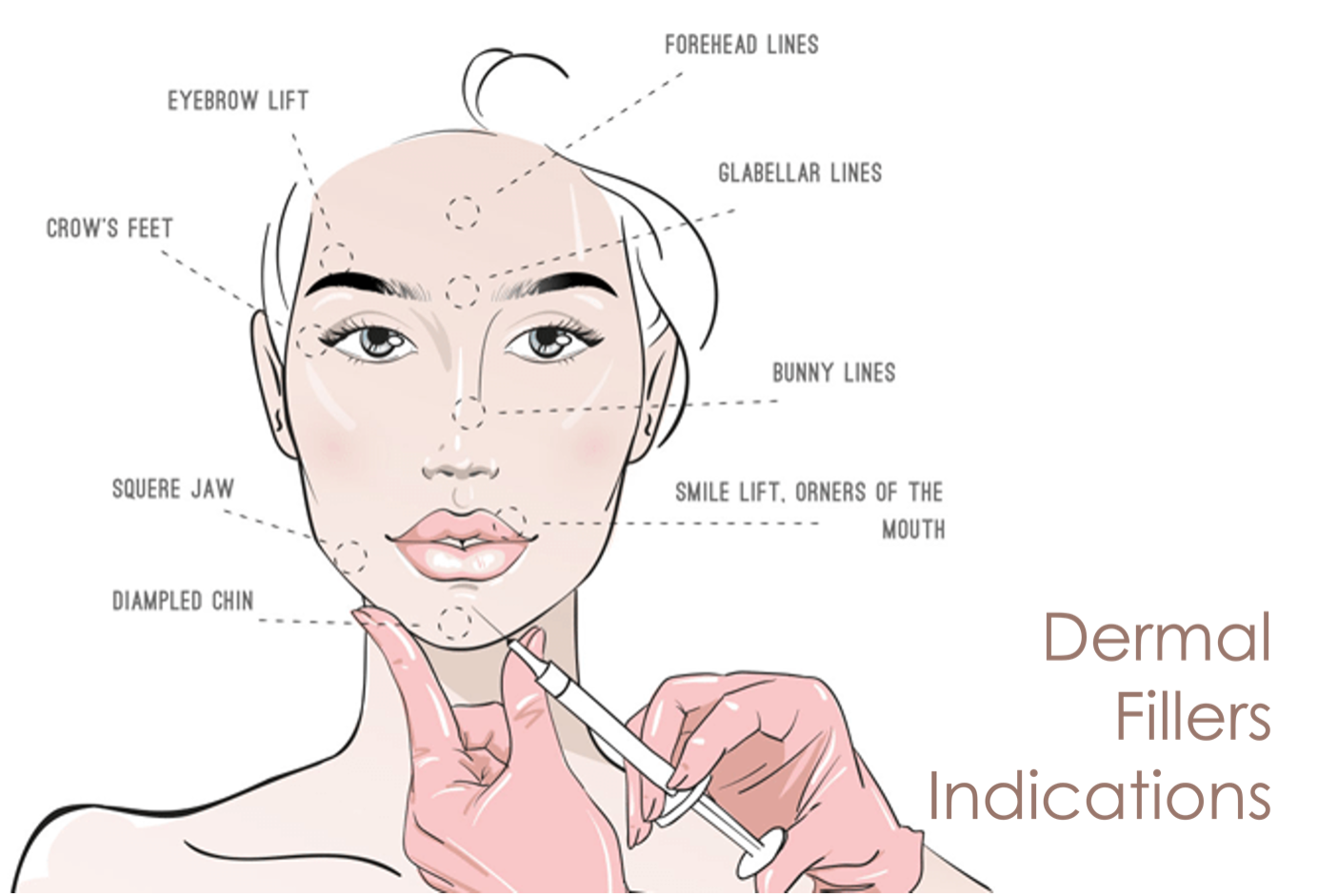 dermal fillers treatment